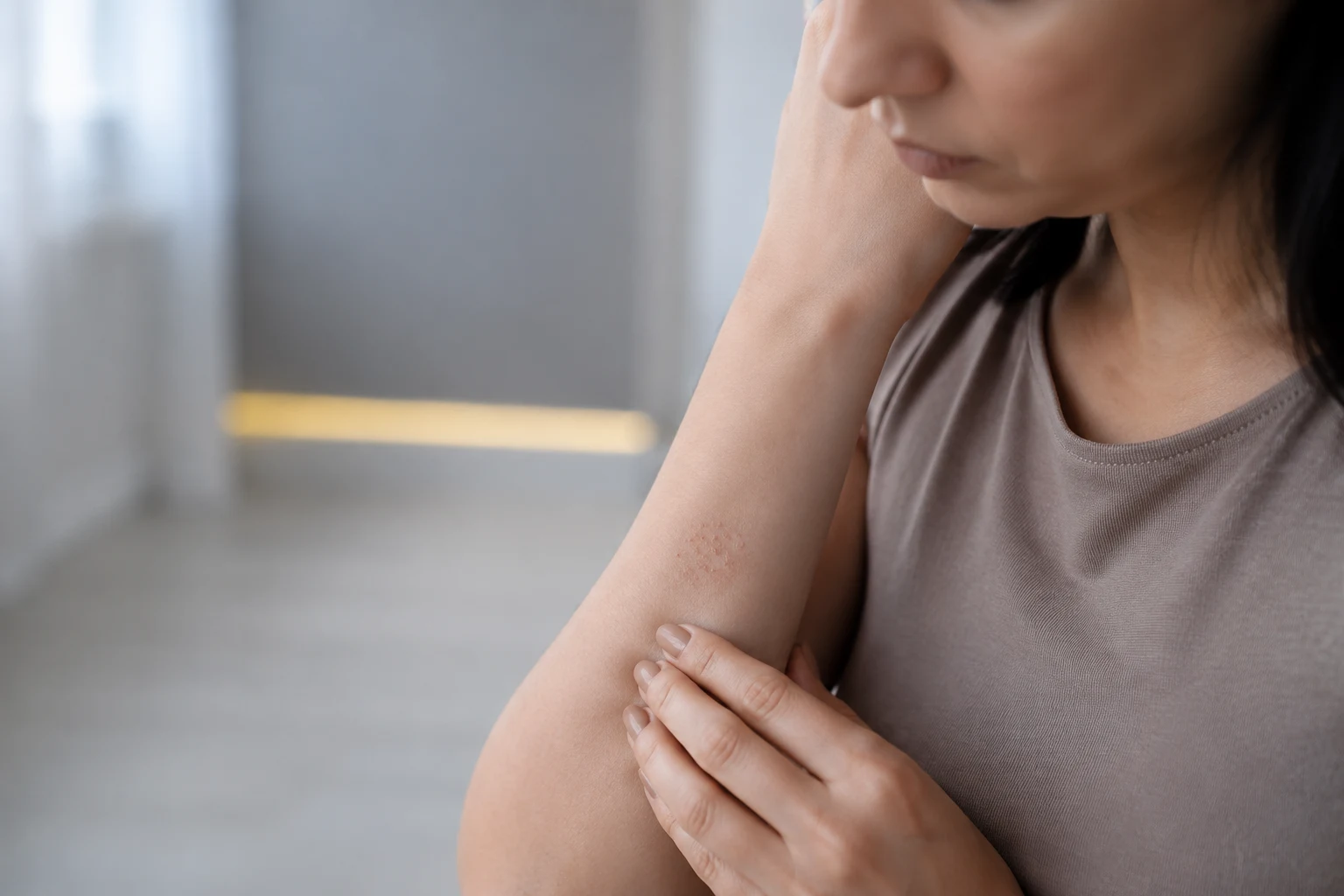 Lesões inflamadas na pele do braço, quadro que exige avaliação dermatológica